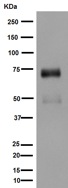 Western blot - Anti-SNPH antibody [EPR14115(2)] (AB192605), expandable thumbnail