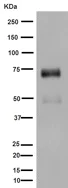 Western blot - Anti-SNPH antibody [EPR14115(2)] (AB192605)