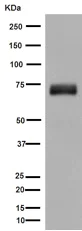 Western blot - Anti-SNPH antibody [EPR14115(2)] (AB192605)