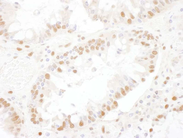 Immunohistochemistry (Formalin/PFA-fixed paraffin-embedded sections) - Anti-SNRNP200 antibody (AB176715)