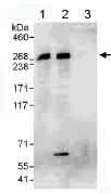 Immunoprecipitation - Anti-SNRNP200 antibody (AB176715)