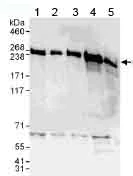 Western blot - Anti-SNRNP200 antibody (AB176715)
