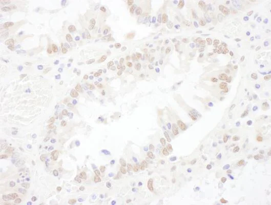 Immunohistochemistry (Formalin/PFA-fixed paraffin-embedded sections) - Anti-SNRNP200 antibody (AB241589)
