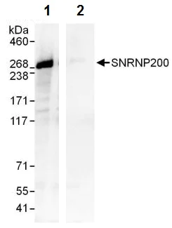 Immunoprecipitation - Anti-SNRNP200 antibody (AB241589)