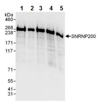 Western blot - Anti-SNRNP200 antibody (AB241589)