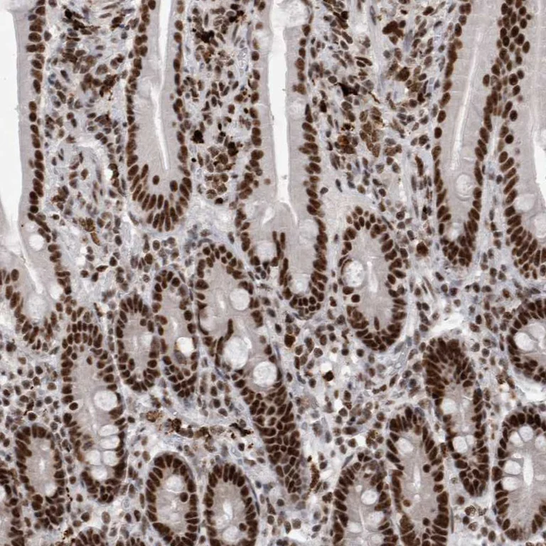Immunohistochemistry (Formalin/PFA-fixed paraffin-embedded sections) - Anti-SNRNP40 antibody (AB254796)