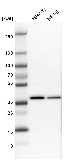 Western blot - Anti-SNRNP40 antibody (AB254796)