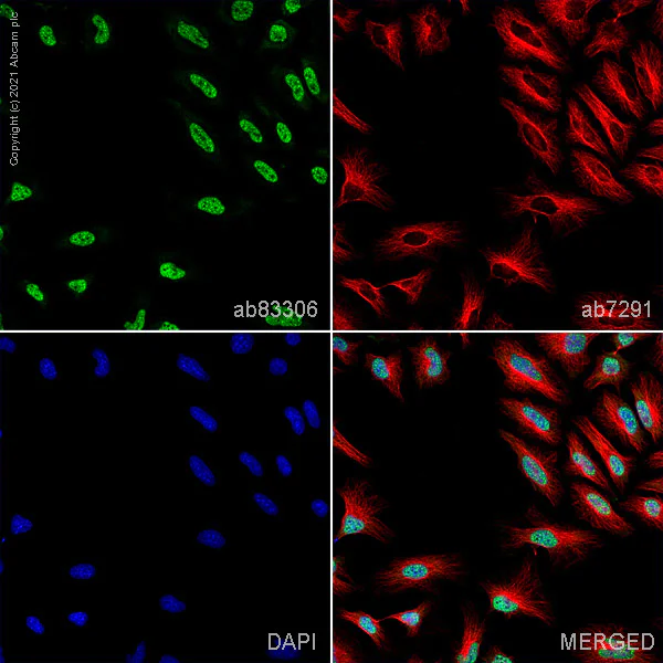 Immunocytochemistry/ Immunofluorescence - Anti-SNRP70/U1-70K antibody (AB83306)