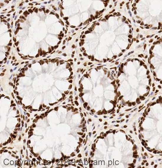 Immunohistochemistry (Formalin/PFA-fixed paraffin-embedded sections) - Anti-SNRP70/U1-70K antibody (AB83306)