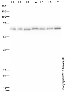 Western blot - Anti-SNRP70/U1-70K antibody (AB83306)
