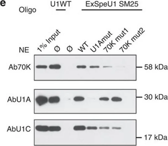 Western blot - Anti-SNRP70/U1-70K antibody (AB83306)
