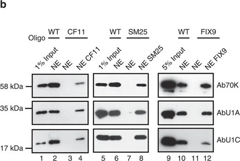 Western blot - Anti-SNRP70/U1-70K antibody (AB83306)