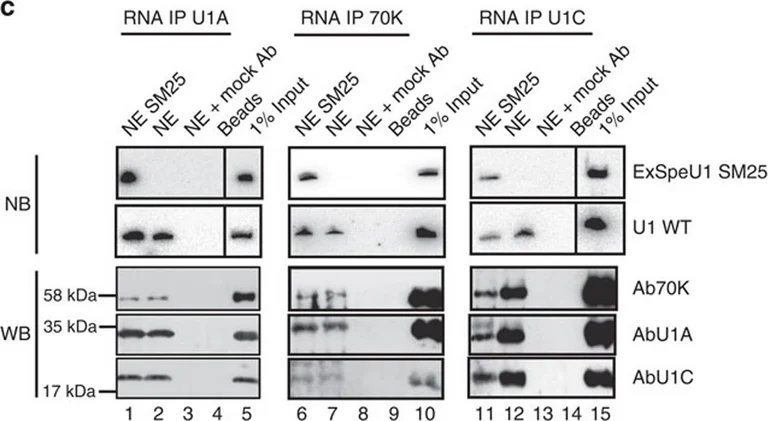 Western blot - Anti-SNRP70/U1-70K antibody (AB83306)