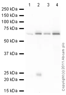 Western blot - Anti-SNRP70/U1-70K antibody (AB83306)