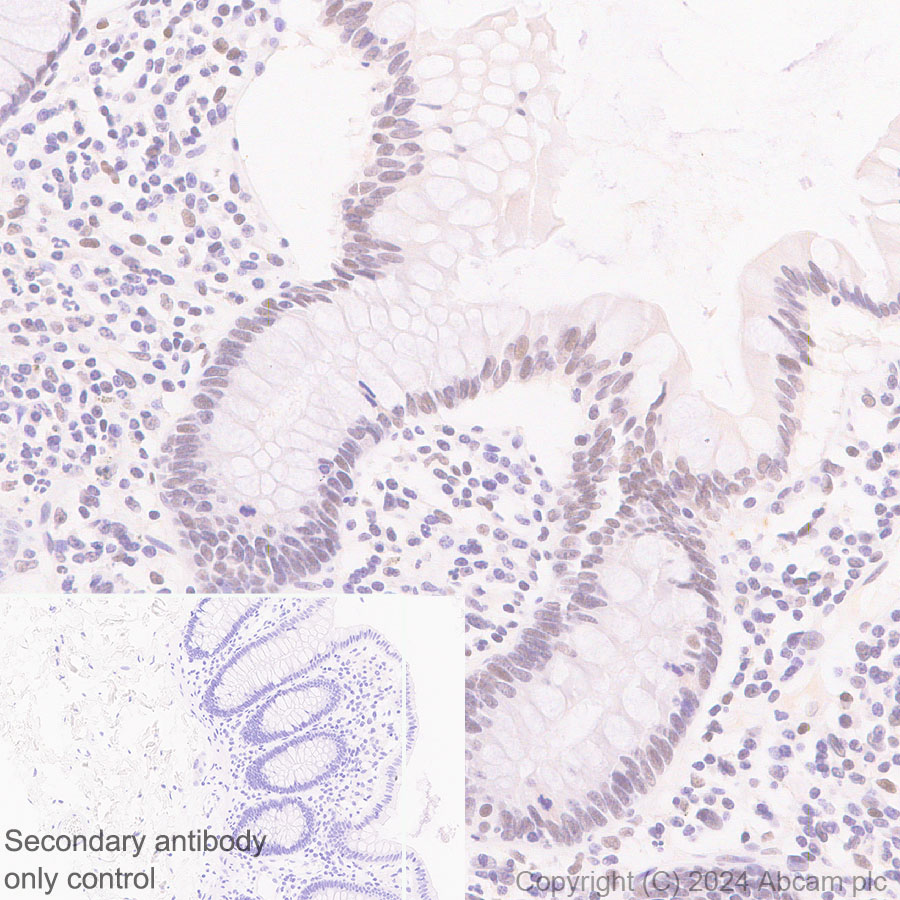 Immunohistochemistry (Formalin/PFA-fixed paraffin-embedded sections) - Anti-SNRP70/U1-70K antibody [EPR28616-89] (AB316762)