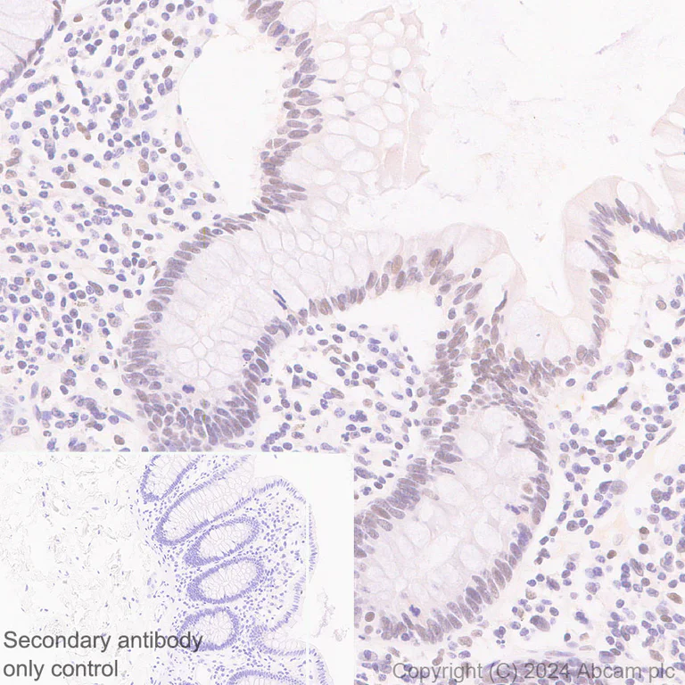 Immunohistochemistry (Formalin/PFA-fixed paraffin-embedded sections) - Anti-SNRP70/U1-70K antibody [EPR28616-89] - BSA and Azide free (AB316763)