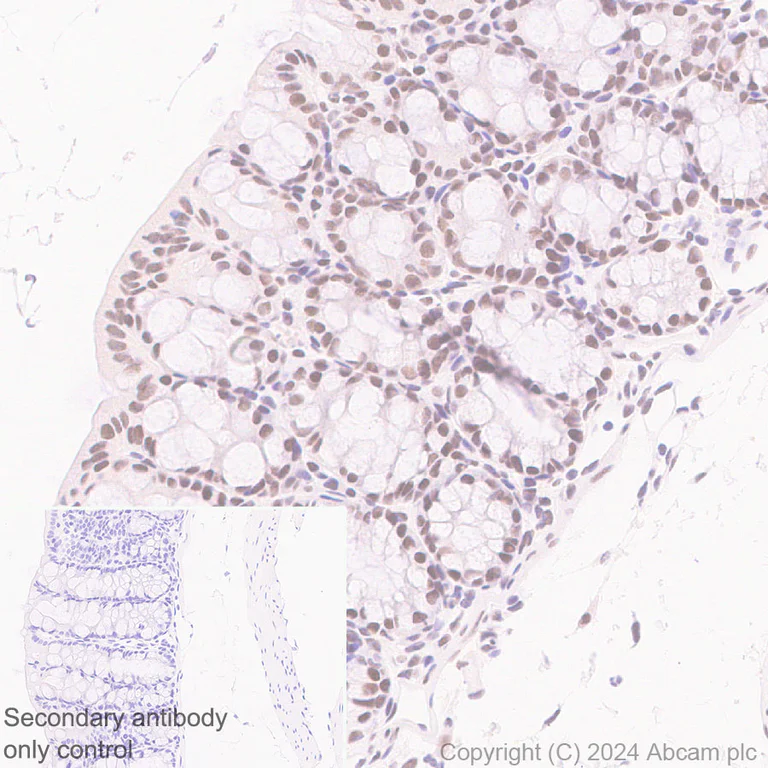 Immunohistochemistry (Formalin/PFA-fixed paraffin-embedded sections) - Anti-SNRP70/U1-70K antibody [EPR28616-89] - BSA and Azide free (AB316763)