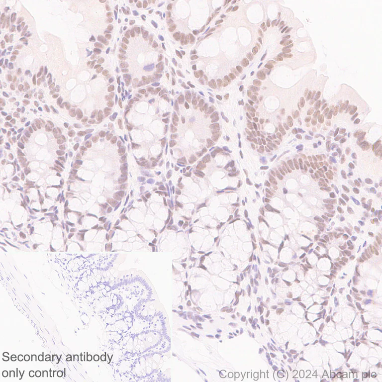 Immunohistochemistry (Formalin/PFA-fixed paraffin-embedded sections) - Anti-SNRP70/U1-70K antibody [EPR28616-89] - BSA and Azide free (AB316763)