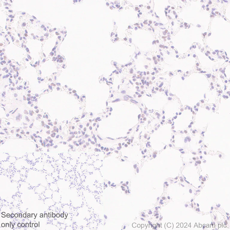Immunohistochemistry (Formalin/PFA-fixed paraffin-embedded sections) - Anti-SNRP70/U1-70K antibody [EPR28616-89] - BSA and Azide free (AB316763)