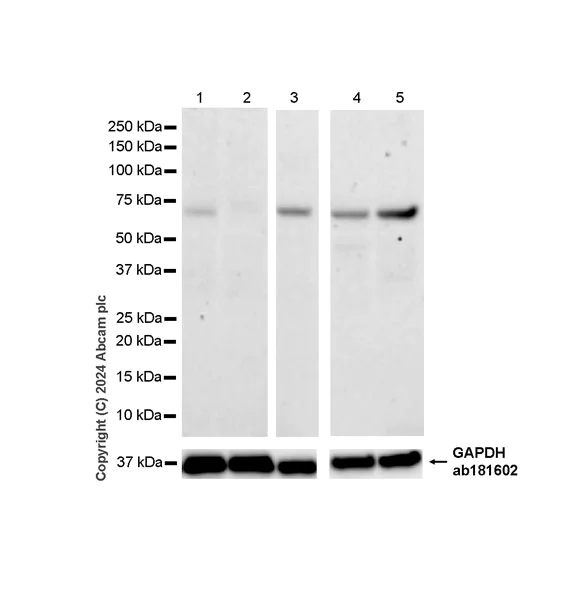 Western blot - Anti-SNRP70/U1-70K antibody [EPR28616-89] - BSA and Azide free (AB316763)