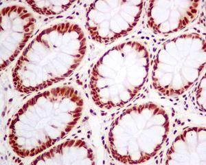 Immunohistochemistry (Formalin/PFA-fixed paraffin-embedded sections) - Anti-SNRPA1 antibody [EPR7557] (AB128937)