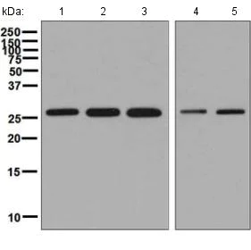 Western blot - Anti-SNRPA1 antibody [EPR7557] (AB128937)