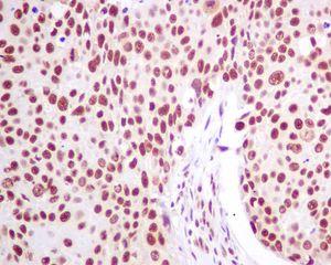 Immunohistochemistry (Formalin/PFA-fixed paraffin-embedded sections) - Anti-SNRPA1 antibody [EPR7557] - BSA and Azide free (AB248231), expandable thumbnail