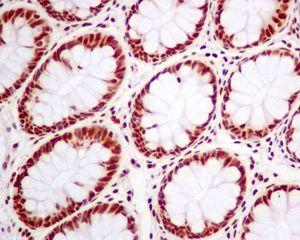Immunohistochemistry (Formalin/PFA-fixed paraffin-embedded sections) - Anti-SNRPA1 antibody [EPR7557] - BSA and Azide free (AB248231), expandable thumbnail