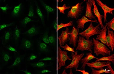 Immunocytochemistry/ Immunofluorescence - Anti-SNRPB/SmB antibody (AB155026)