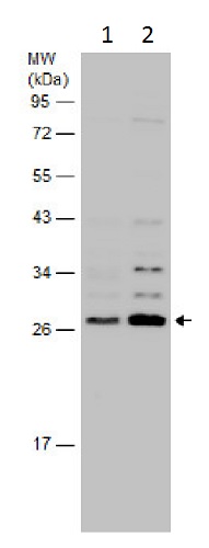 Western blot - Anti-SNRPB2 antibody - N-terminal (AB229560)