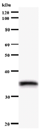 Western blot - Anti-SNRPD1 antibody [3032C3a] (AB59774)