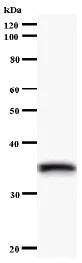 Western blot - Anti-SNRPD1 antibody [3032C3a] (AB59774)