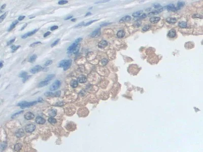 Immunohistochemistry (Formalin/PFA-fixed paraffin-embedded sections) - Anti-SNRPD1 antibody (AB233115)