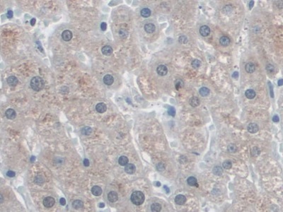 Immunohistochemistry (Formalin/PFA-fixed paraffin-embedded sections) - Anti-SNRPD1 antibody (AB233115)