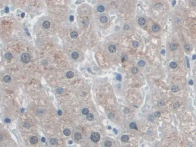 Immunohistochemistry (Formalin/PFA-fixed paraffin-embedded sections) - Anti-SNRPD1 antibody (AB233115)