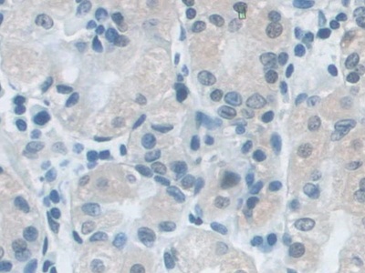 Immunohistochemistry (Formalin/PFA-fixed paraffin-embedded sections) - Anti-SNRPD1 antibody (AB233115)