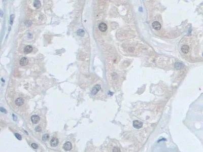 Immunohistochemistry (Formalin/PFA-fixed paraffin-embedded sections) - Anti-SNRPD1 antibody (AB233115)