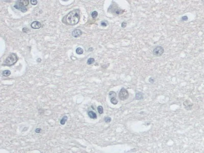 Immunohistochemistry (Formalin/PFA-fixed paraffin-embedded sections) - Anti-SNRPD1 antibody (AB233115)