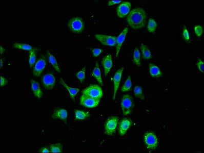 Immunocytochemistry/ Immunofluorescence - Anti-SNRPD1 antibody (AB236902)