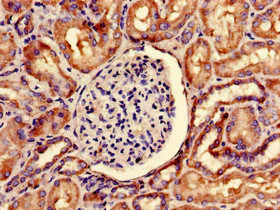 Immunohistochemistry (Formalin/PFA-fixed paraffin-embedded sections) - Anti-SNRPD1 antibody (AB236902)