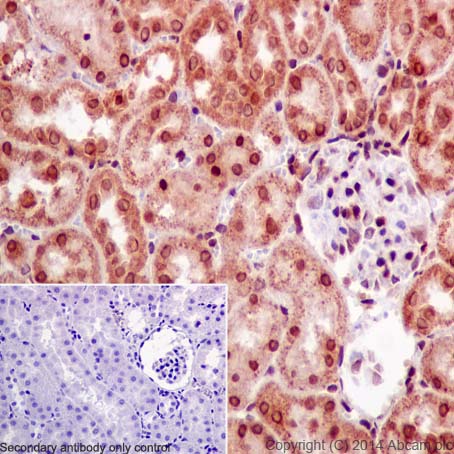 Immunohistochemistry (Formalin/PFA-fixed paraffin-embedded sections) - Anti-SNRPD2 antibody [EPR16762] (AB198296)