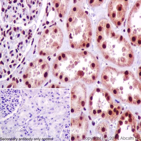 Immunohistochemistry (Formalin/PFA-fixed paraffin-embedded sections) - Anti-SNRPD2 antibody [EPR16762] (AB198296)
