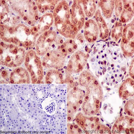 Immunohistochemistry (Formalin/PFA-fixed paraffin-embedded sections) - Anti-SNRPD2 antibody [EPR16762] - BSA and Azide free (AB251254)
