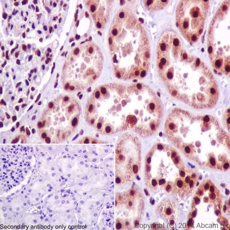 Immunohistochemistry (Formalin/PFA-fixed paraffin-embedded sections) - Anti-SNRPD2 antibody [EPR16762] - BSA and Azide free (AB251254)