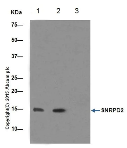 Immunoprecipitation - Anti-SNRPD2 antibody [EPR16762] - BSA and Azide free (AB251254)
