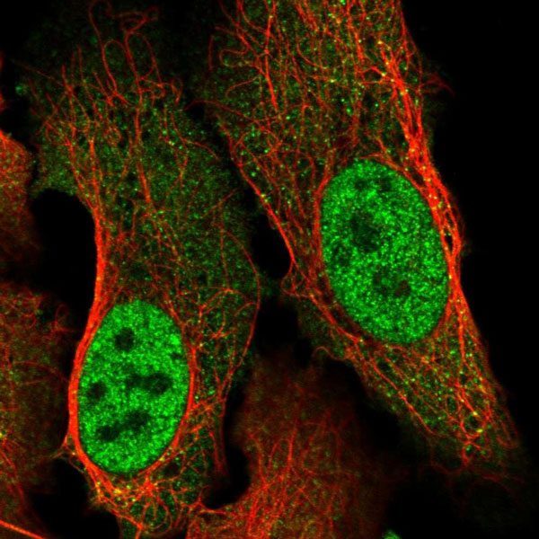 Immunocytochemistry/ Immunofluorescence - Anti-SNRPD3/Sm-D3 antibody (AB121129)