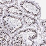 Immunohistochemistry (Formalin/PFA-fixed paraffin-embedded sections) - Anti-SNRPD3/Sm-D3 antibody (AB121129)