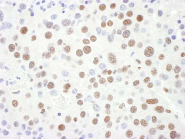 Immunohistochemistry (Formalin/PFA-fixed paraffin-embedded sections) - Anti-SNRPD3/Sm-D3 antibody (AB157118)