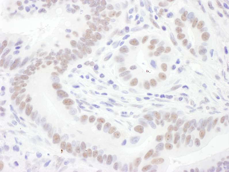 Immunohistochemistry (Formalin/PFA-fixed paraffin-embedded sections) - Anti-SNRPD3/Sm-D3 antibody (AB157118)