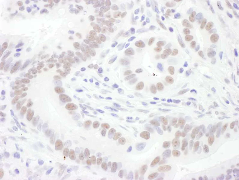 Immunohistochemistry (Formalin/PFA-fixed paraffin-embedded sections) - Anti-SNRPD3/Sm-D3 antibody (AB157118)
